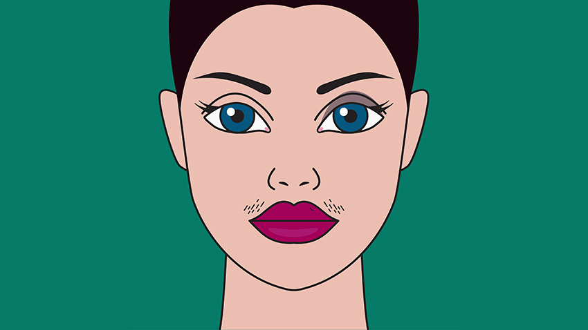 Hirsutism - unwanted facial hair