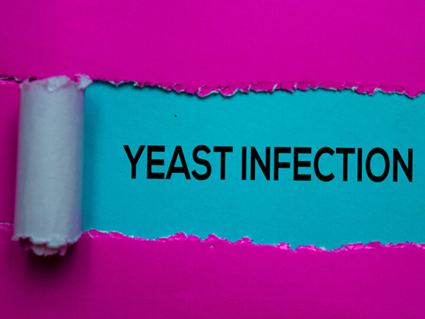 Vaginal Yeast Infections-All You Need to Know