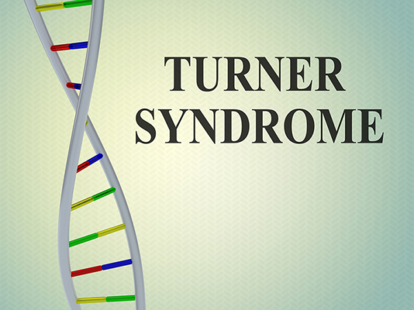 Turner Syndrome-More Than a Missing-X