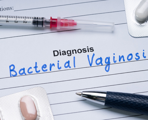 Bacterial Vaginosis: Unraveling the Mystery Behind Causes, Symptoms, and Effective Treatments
