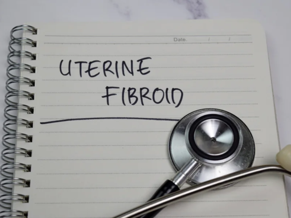 A Deep Dive Into Fibroids