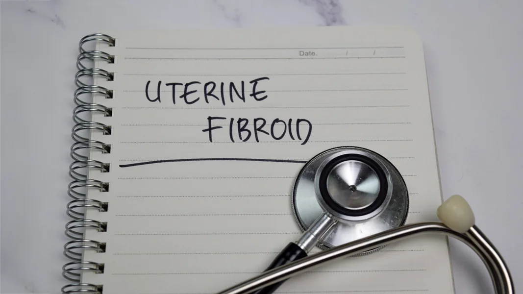 A Deep Dive Into Fibroids